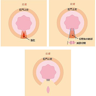 急性期の治療